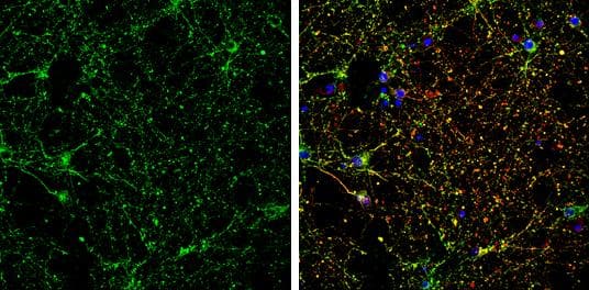 CRMP5 antibody [N1C1] detects CRMP5 protein by immunofluorescent analysis.Sample: DIV10 rat E18 primary cortical neurons were fixed in 4% paraformaldehyde at RT for 15 min.Green: CRMP5 protein stained by CRMP5 antibody [N1C1] (NBP1-33419) diluted at 1:500.Red: beta Tubulin 3/ Tuj1, stained by beta Tubulin 3/ Tuj1 antibody [GT1338]  diluted at 1:500.Blue: Fluoroshield with DAPI . 