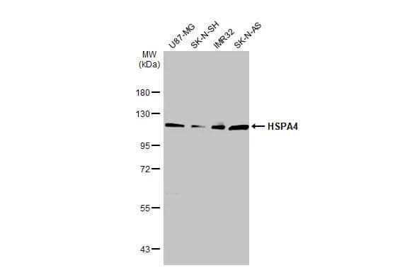 Various whole cell extracts (30 ug) were separated by 7.5% SDS-PAGE, and the membrane was blotted with HSPA4 antibody [N1N3] (NBP1-33425) diluted at 1:1000. The HRP-conjugated anti-rabbit IgG antibody  was used to detect the primary antibody. 