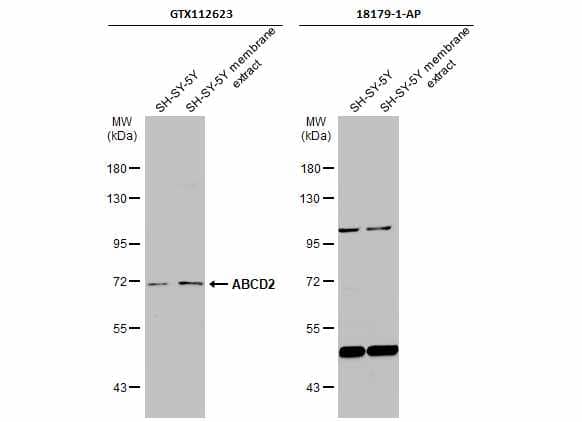 SH-SY5Y whole cell and membrane extracts (30 ug) were separated by 7.5% SDS-PAGE, and the membranes were blotted with ABCD2 antibody [N3C2], Internal (NBP1-33435) diluted at 1:500 and competitor's antibody (18179-1-AP) diluted at 1:500. The HRP-conjugated anti-rabbit IgG antibody  was used to detect the primary antibody.*The competitor is not affiliated with Novus and does not endorse this product. 