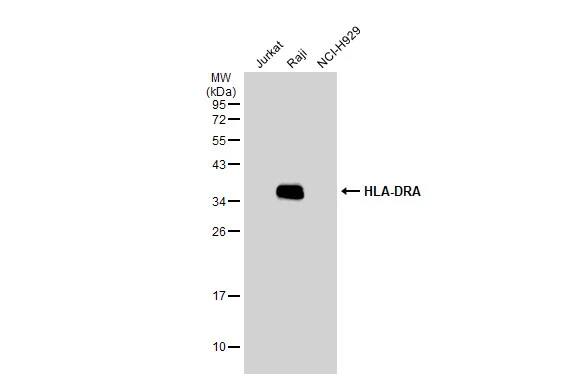 Western Blot: HLA DRA Antibody [NBP1-33458] - Various whole cell extracts (30 ug) were separated by 12% SDS-PAGE, and the membrane was blotted with HLA DRA antibody [N2C3] (NBP1-33458) diluted at 1:1000. The HRP-conjugated anti-rabbit IgG antibody  was used to detect the primary antibody.