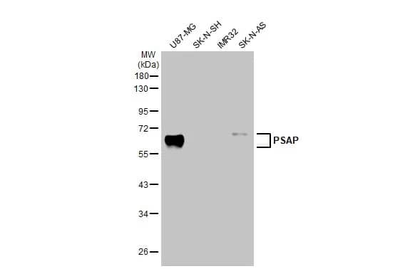 Western Blot: PSAP Antibody [NBP1-33459] - Various extracts (30 ug) were separated by 10% SDS-PAGE, and the membrane was blotted with PSAP antibody [N1N3] (NBP1-33459) diluted at 1:2000. The HRP-conjugated anti-rabbit IgG antibody  was used to detect the primary antibody.