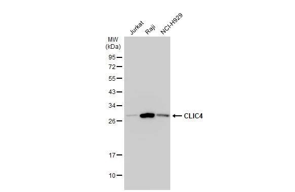 Western Blot: CLIC4 Antibody [NBP1-33474] - Various whole cell extracts (30 ug) were separated by 12% SDS-PAGE, and the membrane was blotted with CLIC4 antibody (NBP1-33474) diluted at 1:1000. The HRP-conjugated anti-rabbit IgG antibody  was used to detect the primary antibody.
