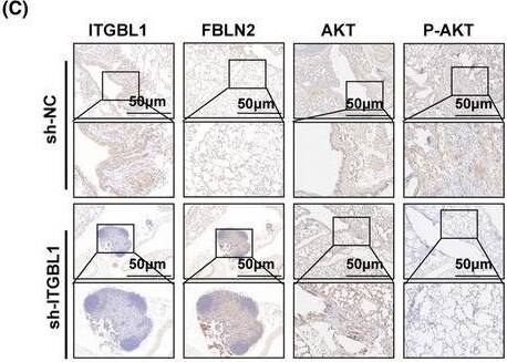 The ITGBL1/FBLN2 axis promoted lung metastasis of AR‐GC cells in vivo. (A) Images of mouse lungs after transplantation with AR‐MKN45 cells and ITGBL1‐knockdown AR‐MKN45 cells. (B) Typical images of haematoxylin–eosin staining in lung metastases from the sh‐NC and sh‐ITGBL1 groups. Scale bar, 50 μm. (C) The expression of ITGBL1, FBLN2, AKT, and P‐AKT in mouse lung tissues in the sh‐NC group and the sh‐ITGBL1 group was determined by IHC experiments. Scale bar, 50 μm. (D) The protein expression of FBLN2 in ITGBL1‐knockdown AR‐MKN45 cells after infection with lentivirus carrying FBLN2 siRNA. GAPDH served as a loading control. The quantification of Western blot band densities was performed using the ImageJ program. (E) Images of mouse lungs after transplantation with ITGBL1‐knockdown AR‐MKN45 cells and ITGBL1/FBLN2 double‐knockdown AR‐MKN45 cells. (F) Typical images of haematoxylin–eosin staining in lung metastases from the sh‐ITGBL1 and sh‐ITGBL1 + sh‐FBLN2 groups. Scale bar, 50 μm. (G) The expression of ITGBL1, FBLN2, AKT, and P‐AKT in mouse lung tissues in the sh‐ITGBL1 group and the sh‐ITGBL1 + sh‐FBLN2 group was determined by IHC experiments. Scale bar, 50 μm. (H) Diagrammatic representation of the ITGBL1/AKT/FBLN2 axis's regulation mechanisms in GC anoikis resistance and metastasis. The experiments were conducted in triplicate. The values were represented as means with standard deviations (SD), and the statistical significance was assessed using Student's t‐test. Nonsignificant results were denoted as ‘ns’, while significance levels were shown as *p < 0.05, **p < 0.01, and ***p < 0.001. Image collected and cropped by CiteAb from the following open publication (//pubmed.ncbi.nlm.nih.gov/38332530), licensed under a CC-BY license. Not internally tested by Novus Biologicals.
