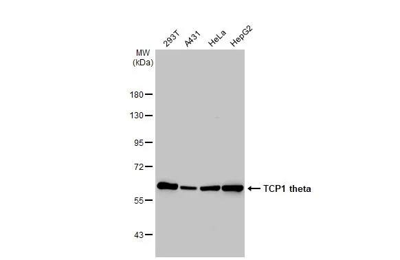 Western Blot: CCT8 Antibody [NBP1-33486] - Various whole cell extracts (30 ug) were separated by 7.5% SDS-PAGE, and the membrane was blotted with CCT8 antibody [N2C2], Internal (NBP1-33486) diluted at 1:1000. The HRP-conjugated anti-rabbit IgG antibody  was used to detect the primary antibody.