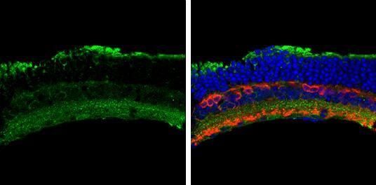 Activin A Receptor type I antibody detects Activin A Receptor type I protein by immunohistochemical analysis.Sample: Frozen sectioned adult mouse retina. Green: Activin A Receptor type I protein stained by Activin A Receptor type I antibody (NBP1-33500) diluted at 1:250.Red: Protein kinase C alpha staining.Blue: Fluoroshield with DAPI . br>Antigen Retrieval: Trilogy(TM) (EDTA based, pH 8.0) buffer, 15min 