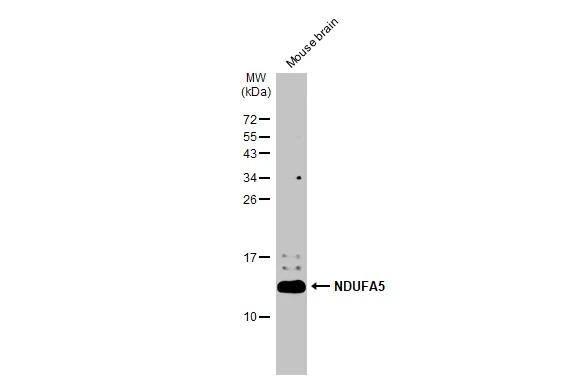 Mouse tissue extract (50 ug) was separated by 15% SDS-PAGE, and the membrane was blotted with NDUFA5 antibody [N1C3] (NBP1-33504) diluted at 1:1000. The HRP-conjugated anti-rabbit IgG antibody  was used to detect the primary antibody. 