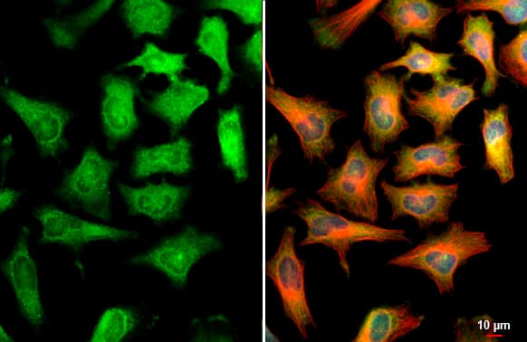 Immunocytochemistry/ Immunofluorescence: CBS Antibody [NBP1-33518] - CBS antibody detects CBS protein at cytoplasm and nucleus by immunofluorescent analysis.Sample: HeLa cells were fixed in ice-cold MeOH for 5 min.Green: CBS stained by CBS antibody (NBP1-33518) diluted at 1:500.Red: alpha Tubulin, a cytoskeleton marker, stained by alpha Tubulin antibody [GT114]  diluted at 1:1000.Blue: Fluoroshield with DAPI .Scale bar= 10um.