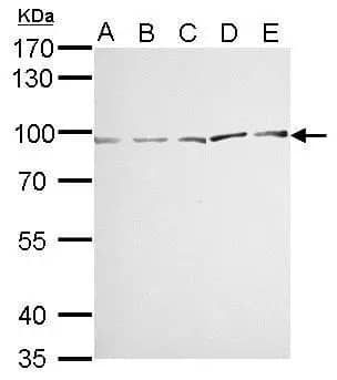 Western Blot: MVP Antibody [NBP1-33560] - MVP antibody detects MVP protein by western blot analysis.A. 30 ug Neuro2A whole cell lysate/extract B. 30 ug GL261 whole cell lysate/extract C. 30 ug C8D30 whole cell lysate/extract D. 30 ug BCL-1 whole cell lysate/extract E. 30 ug Raw264.7 whole cell lysate/extract7.5% SDS-PAGEMVP antibody (NBP1-33560) dilution: 1:1000 The HRP-conjugated anti-rabbit IgG antibody  was used to detect the primary antibody.