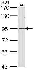 Western Blot: MVP Antibody [NBP1-33560] - Sample (30 ug of whole cell lysate)  A: Molt-4   7.5% SDS PAGE  NBP1-33560 diluted at 1:1000 The HRP-conjugated anti-rabbit IgG antibody  was used to detect the primary antibody.