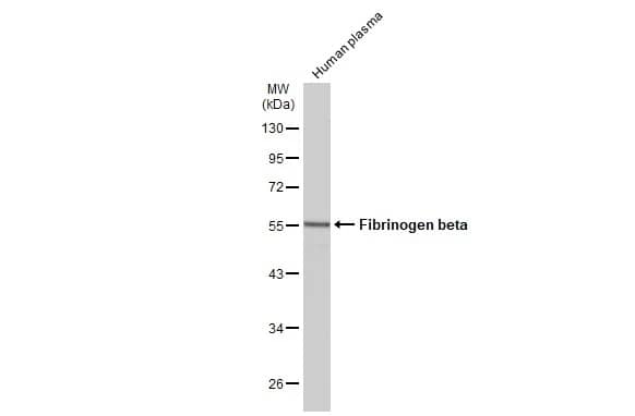 Western Blot Fibrinogen beta chain Antibody - BSA Free