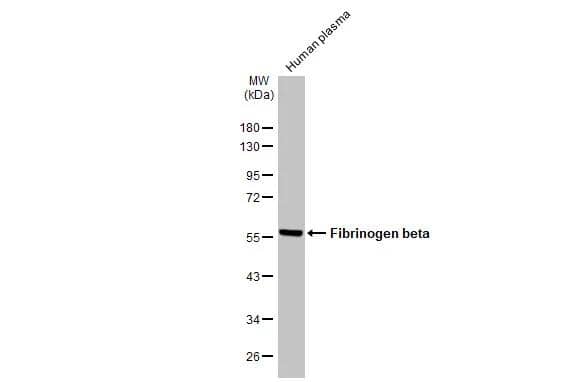 Western Blot Fibrinogen beta chain Antibody - BSA Free