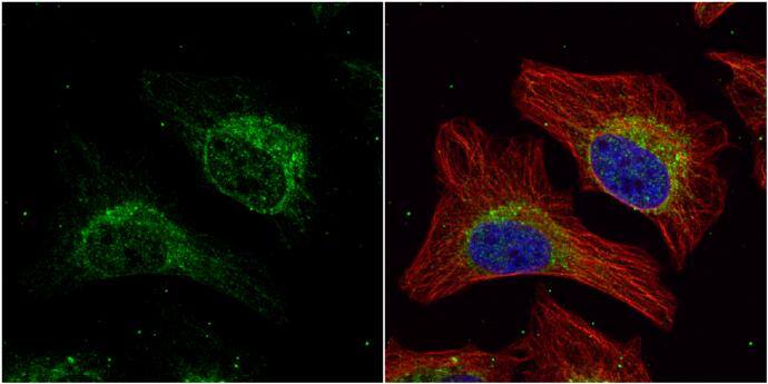 HADHA antibody [N2C1], Internal detects HADHA protein at cytoplasm by immunofluorescent analysis.Sample: HeLa cells were fixed in 4% paraformaldehyde at RT for 15 min.Green: HADHA protein stained by HADHA antibody [N2C1], Internal (NBP1-33588) diluted at 1:500.Red: alpha Tubulin, a cytoskeleton marker, stained by alpha Tubulin antibody [GT114]  diluted at 1:1000.Blue: Hoechst 33342 staining. 