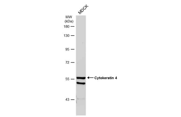 Western Blot: Cytokeratin 4 Antibody [NBP1-33592] - Whole cell extract (30 ug) was separated by 7.5% SDS-PAGE, and the membrane was blotted with Cytokeratin 4 antibody (NBP1-33592) diluted at 1:1000. The HRP-conjugated anti-rabbit IgG antibody  was used to detect the primary antibody, and the signal was developed with Trident ECL plus-Enhanced.