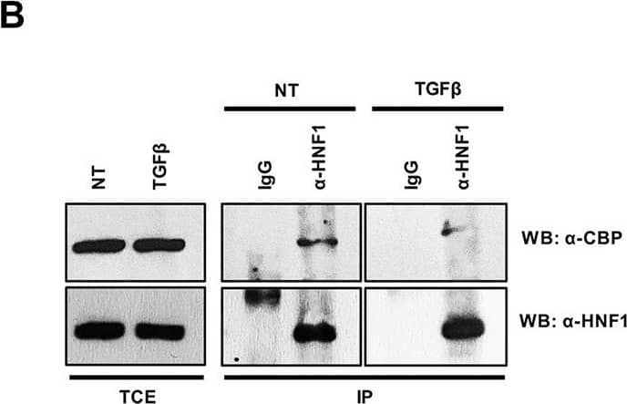 Western Blot: HNF1 Antibody [NBP1-33596] - (A) Analysis of CBP/p300 DNA binding activity after TGF beta  treatment. qPCR analysis of chromatin immunoprecipitated with anti-CBP/p300 antibody from hepatocytes untreated or treated with TGF beta  (for 5 h) was performed. HNF1 alpha  consensus regions embedded in the indicated target gene promoters were analyzed. A HNF1 alpha  nonbound region of Neurogenin 1 promoter was utilized as negative control. Data are normalized to total chromatin input & background (control immunoprecipitation with IgG) & expressed as % input. Mean ± SEM of qPCR data obtained in triplicate from three independent experiments are reported. (B)In vivo coimmunoprecipitation of HNF1 alpha  & CBP/p300 in hepatocytes untreated or treated with TGF beta  (for 5 h). Cells were lysed, immunoprecipitated with anti-HNF1 alpha  antibody, & then analyzed by Western blotting with the indicated antibodies. As control, the immunoprecipitation with normal goat IgG was performed. TCE, total cell extracts. Densitometric analysis of WB data from three independent experiments is shown. (C) Analysis of HNF1 alpha  protein PTMs following TGF beta  treatment. Nuclear extracts from control hepatocytes (upper panel) & HNF1 alpha Myc-overexpressing hepatocytes treated for 3 h with TGF beta  (lower panel) or left untreated (middle panel). Samples were separated by two-dimensional gel electrophoresis followed by Western blotting with anti-Myc-Tag antibody. HNF1 alpha -specific spots are indicated by the arrow. The appearance of multiple spots in TGF beta -treated hepatocytes can be observed. **p <0.05, **p<0.01. Image collected & cropped by CiteAb from the following publication (//pubmed.ncbi.nlm.nih.gov/31543815), licensed under a CC-BY license. Not internally tested by Novus Biologicals.