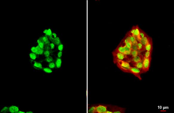 Immunocytochemistry/ Immunofluorescence: HNF1 Antibody [NBP1-33596] - HNF1 antibody [N1N3] detects HNF1 protein at nucleus by immunofluorescent analysis.Sample: HepG2 cells were fixed in 4% paraformaldehyde at RT for 15 min.Green: HNF1 stained by HNF1 antibody [N1N3] (NBP1-33596) diluted at 1:500.Red: alpha Tubulin, a cytoskeleton marker, stained by alpha Tubulin antibody [GT114]  diluted at 1:1000.Scale bar= 10um.