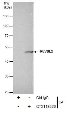 Immunoprecipitation of RUVBL2 protein from 293T whole cell extracts using 5 ug of RUVBL2 antibody [N1C1] (NBP1-33599).Western blot analysis was performed using RUVBL2 antibody [N1C1] (NBP1-33599).EasyBlot anti-Rabbit IgG  was used as a secondary reagent. 