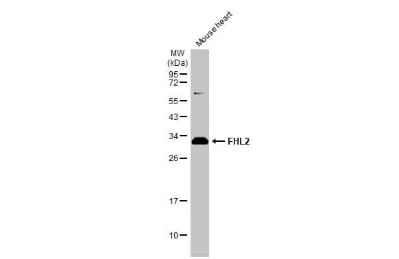 Western Blot: FHL2 Antibody [NBP1-33602] - Mouse tissue extract (50 ug) was separated by 12% SDS-PAGE, and the membrane was blotted with FHL2 antibody (NBP1-33602) diluted at 1:1000. The HRP-conjugated anti-rabbit IgG antibody  was used to detect the primary antibody.