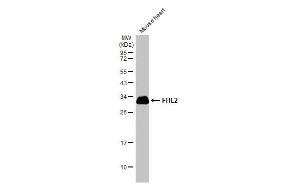 Western Blot: FHL2 Antibody [NBP1-33603] - Mouse tissue extract (50 ug) was separated by 12% SDS-PAGE, and the membrane was blotted with FHL2 antibody (NBP1-33603) diluted at 1:1000. The HRP-conjugated anti-rabbit IgG antibody  was used to detect the primary antibody.