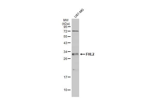 Western Blot: FHL2 Antibody [NBP1-33603] - Whole cell extract (30 ug) was separated by 12% SDS-PAGE, and the membrane was blotted with FHL2 antibody (NBP1-33603) diluted at 1:1000. The HRP-conjugated anti-rabbit IgG antibody  was used to detect the primary antibody.