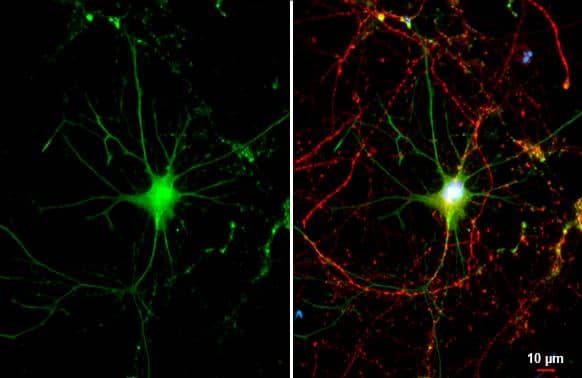 Renin Receptor antibody [N3C3] detects Renin Receptor protein by immunofluorescent analysis.Sample: DIV9 rat hippocampal neuron cells were fixed in 4% paraformaldehyde at RT for 15 min.Green: Renin Receptor stained by Renin Receptor antibody [N3C3] (NBP1-33605) diluted at 1:500.Red: Tau, an axon marker, stained by Tau antibody [GT287]  diluted at 1:500.Blue: Fluoroshield with DAPI . 