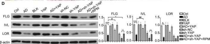The effect of YAP expression on skin barrier in AD mice. (A) Trans epidermal water loss (TEWL) and stratum corneum hydration (SCH) of each group. (B) YAP protein expression from immunohistochemistry with the quantification results shown in the graphs (×400), bar length = 50 μm. n = 3. (C) Filaggrin (FLG) protein expression from immunohistochemistry with the quantification results shown in the graphs (×400), bar length = 50 μm. n = 3. (D) FLG, involucrin (IVL), and loricrin (LOR) protein expression from western blot with the quantification results shown in the graphs. (E) YAP, p-YAP, mTOR, and p-mTOR protein expression from western blot with the quantification results shown in the graphs. Ctrl, control mice; AD, atopic dermatitis model mice; BLK, mice injected with empty vector lentivirus; YAP, mice injected with YAP overexpression lentivirus; AD+YAP, atopic dermatitis model mice injected with YAP overexpression lentivirus; sh-NC, mice injected with shRNA-NC lentivirus; sh-YAP, mice injected with YAP shRNA lentivirus; AD+sh-YAP, atopic dermatitis model mice injected with YAP shRNA lentivirus; AD+sh-YAP+RPM, AD+sh-YAP group with topical 0.2% rapamycin ointment. *P < 0.05, ***P < 0.001 Ctrl v.s. AD; #P < 0.05, ##P < 0.01, ###P < 0.001 AD+YAP v.s. AD; +P < 0.05, +++P < 0.001 AD+sh-YAP v.s. AD; ^^P < 0.01, ^^^P < 0.001 AD+sh-YAP+RPM v.s. AD+sh-YAP. Image collected and cropped by CiteAb from the following open publication (//www.frontiersin.org/articles/10.3389/fimmu.2025.1681148/full), licensed under a CC-BY license. Not internally tested by Novus Biologicals.