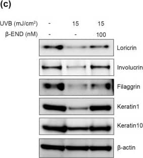 Treatment with  beta -endorphin salvaged UVB irradiation-induced increased proliferation and reduced the expression of epidermal differentiation markers in NHKs. (a) Representative images of 5-ethynyl-2ʹ-deoxyuridine (EdU)-positive cells in keratinocytes after UVB irradiation, followed by  beta -endorphin treatment for 24 h. DAPI: 4′,6-diamidino-2-phenylindole. The histogram shows the quantification of EdU as the percentage of cells with positive staining. (b) NHKs were exposed to 15 mJ/cm2 of UVB light, followed by 100 nM  beta -endorphin treatment for 48 h. RNA was isolated, and the mRNA expression of loricrin, involucrin, filaggrin, keratin 1, and keratin 10 was analyzed using RT-qPCR. Each mRNA level was normalized to that of the ribosomal gene ribosomal protein L13a (RPL13A). (c) Representative immunoblots showing differentiation markers expression levels. The original blots are presented in Supplementary Fig. S4. The protein expression levels of differentiation markers were determined via western blot analysis, and the quantification of these proteins is shown in the histogram. Data are presented as the mean +/- SEM of six independent experiments. # p < 0.05, ##p<0.01, ### p < 0.001 compared to the non-irradiated group, and * p < 0.05, ** p < 0.01, *** p < 0.001 compared to the irradiated vehicle-treated group. Image collected and cropped by CiteAb from the following open publication (//www.nature.com/articles/s41598-023-49886-5), licensed under a CC-BY license. Not internally tested by Novus Biologicals.