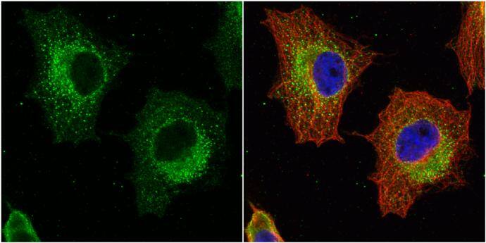 GSTP1 antibody [N1N2], N-term detects GSTP1 protein at cytoplasm by immunofluorescent analysis.Sample: HeLa cells were fixed in 4% paraformaldehyde at RT for 15 min.Green: GSTP1 protein stained by GSTP1 antibody [N1N2], N-term (NBP1-33627) diluted at 1:500.Red: alpha Tubulin, a cytoskeleton marker, stained by alpha Tubulin antibody [GT114]  diluted at 1:1000.Blue: Hoechst 33342 staining. 
