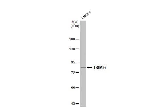 Whole cell extract (30 ug) was separated by 7.5% SDS-PAGE, and the membrane was blotted with TRIM36 antibody [C3], C-term (NBP1-33644) diluted at 1:1000. The HRP-conjugated anti-rabbit IgG antibody  was used to detect the primary antibody. 