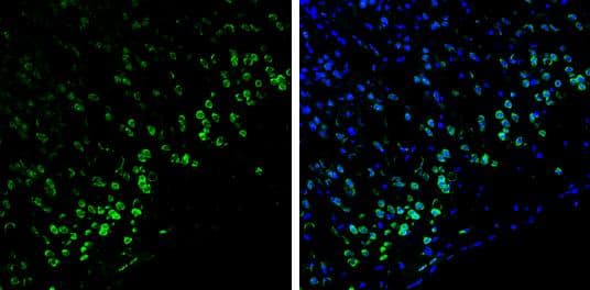 Syntenin 1 antibody [C2C3], C-term detects Syntenin 1 protein by immunohistochemical analysis. Samples: Frozen Sectioned adult mouse brain.Green: Syntenin 1 protein stained by Syntenin 1 antibody [C2C3], C-term (NBP1-33661) diluted at 1:250.Blue: Fluoroshield with DAPI . br>Antigen Retrieval: Citrate buffer, pH 6.0, 10 min 