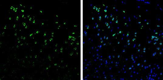 Syntenin 1 antibody [C2C3], C-term detects Syntenin 1 protein by immunohistochemical analysis. Samples: Frozen Sectioned adult mouse brain.Green: Syntenin 1 protein stained by Syntenin 1 antibody [C2C3], C-term (NBP1-33661) diluted at 1:250.Blue: Fluoroshield with DAPI . br>Antigen Retrieval: Citrate buffer, pH 6.0, 10 min 