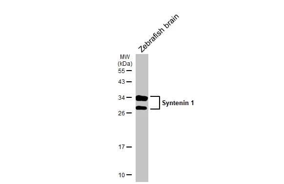 Zebrafish tissue extract (30 ug) was separated by 12% SDS-PAGE, and the membrane was blotted with Syntenin 1 antibody [C2C3], C-term (NBP1-33661) diluted at 1:1000. The HRP-conjugated anti-rabbit IgG antibody  was used to detect the primary antibody. 