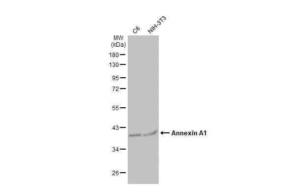 Western Blot: Annexin A1 Antibody [NBP1-33684] - Various whole cell extracts (30 ug) were separated by 10% SDS-PAGE, and the membrane was blotted with Annexin A1 antibody (NBP1-33684) diluted at 1:10000. The HRP-conjugated anti-rabbit IgG antibody  was used to detect the primary antibody.