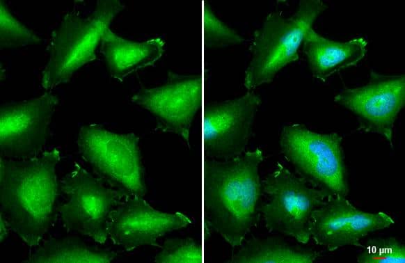Annexin A1 antibody detects Annexin A1 protein by immunofluorescent analysis.Sample: HeLa cells were fixed in 4% paraformaldehyde at RT for 15 min.Green: Annexin A1 stained by Annexin A1 antibody (NBP1-33684) diluted at 1:500.Blue: Fluoroshield with DAPI .Scale bar= 10 um. 