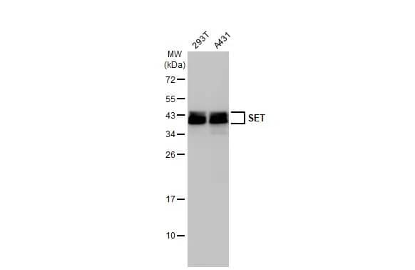 Western Blot: SET Antibody [NBP1-33713] - Various whole cell extracts (30 ug) were separated by 12% SDS-PAGE, and the membrane was blotted with SET antibody (NBP1-33713) diluted at 1:1000. The HRP-conjugated anti-rabbit IgG antibody  was used to detect the primary antibody.