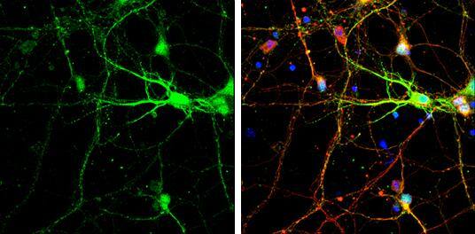SNAP25 antibody detects SNAP25 protein at cell body and synaptic vesicles by immunofluorescent analysis.Sample: DIV9 rat E18 primary cortical neurons were fixed in 4% paraformaldehyde at RT for 15 min.Green: SNAP25 protein stained by SNAP25 antibody (NBP1-33714) diluted at 1:500.Red: beta Tubulin 3/ Tuj1, a neuron cell marker, stained by beta Tubulin 3/ Tuj1 antibody [GT11710]  diluted at 1:500.Blue: Fluoroshield with DAPI . 
