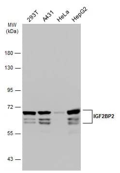 Western Blot: IMP2/IGF2BP2 Antibody [NBP1-33728] - Various whole cell extracts (30 ug) were separated by 7.5% SDS-PAGE, and the membrane was blotted with IMP2/IGF2BP2 antibody (NBP1-33728) diluted at 1:3000. The HRP-conjugated anti-rabbit IgG antibody  was used to detect the primary antibody.