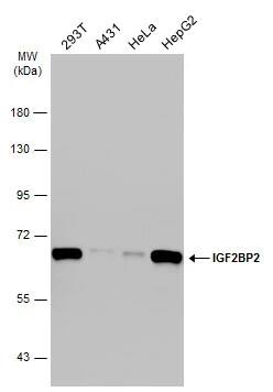 Western Blot: IMP2/IGF2BP2 Antibody [NBP1-33729] - Various whole cell extracts (30 ug) were separated by 7.5% SDS-PAGE, and the membrane was blotted with IMP2/IGF2BP2 antibody (NBP1-33729) diluted at 1:500. The HRP-conjugated anti-rabbit IgG antibody  was used to detect the primary antibody.