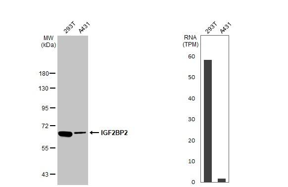 Various whole cell extracts (30 ug) were separated by 7.5% SDS-PAGE, and the membrane was blotted with IGF2BP2 antibody (NBP1-33729) diluted at 1:500. The HRP-conjugated anti-rabbit IgG antibody  was used to detect the primary antibody. Corresponding RNA expression data for the same cell lines are based on Human Protein Atlas program. 