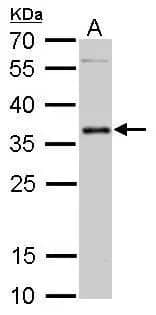 Western Blot: PIM2 Antibody [NBP1-33731] - PIM2 antibody detects PIM2 protein by Western blot analysis.A. 50 ug mouse testis lysate/extract 12 % SDS-PAGEPIM2 antibody (NBP1-33731) dilution: 1:500