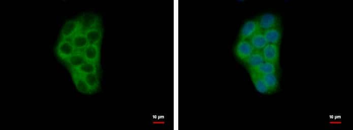 Calcium binding protein P22 antibody detects Calcium binding protein P22 protein at cytoplasm by immunofluorescent analysis.Sample: HepG2 cells were fixed in 4% paraformaldehyde at RT for 15 min.Green: Calcium binding protein P22 protein stained by Calcium binding protein P22 antibody (NBP1-33736) diluted at 1:500.Blue: Hoechst 33342 staining. 