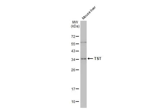 Western Blot: TST Antibody [NBP1-33771] - Mouse tissue extracts (50 ug) was separated by 12% SDS-PAGE, and the membrane was blotted with TST antibody (NBP1-33771) diluted at 1:1000. The HRP-conjugated anti-rabbit IgG antibody  was used to detect the primary antibody.