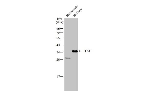 Western Blot: TST Antibody [NBP1-33771] - Various tissue extracts (50 ug) were separated by 12% SDS-PAGE, and the membrane was blotted with TST antibody (NBP1-33771) diluted at 1:3000. The HRP-conjugated anti-rabbit IgG antibody  was used to detect the primary antibody.