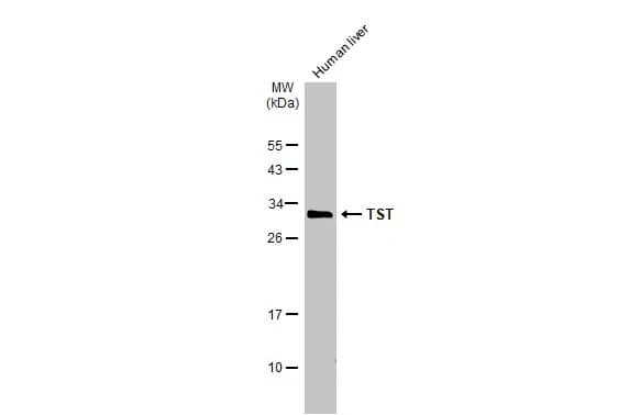 Western Blot: TST Antibody [NBP1-33771] - Human tissue extract (50 ug) was separated by 12% SDS-PAGE, and the membrane was blotted with TST antibody (NBP1-33771) diluted at 1:3000. The HRP-conjugated anti-rabbit IgG antibody  was used to detect the primary antibody.