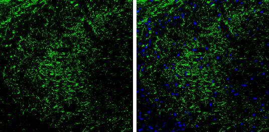 PKA 2 beta antibody detects PKA 2 beta protein by immunohistochemical analysis. Samples: Frozen Sectioned adult mouse hippocampus.Green: PKA 2 beta protein stained by PKA 2 beta antibody (NBP1-33773) diluted at 1:250.Blue: Fluoroshield with DAPI . br>Antigen Retrieval: Citrate buffer, pH 6.0, 10 min 