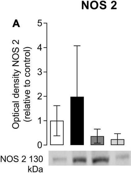 Effects of omega-3 supplementation on the immunocontent of macrophages M1 markers: nitric oxide synthase 2 (NOS-2) (A) and CD86 (B), and M2 marker: Arginase-1 (C) on the mouse paw muscle 48 h after the model induction in Saline/Sham, Saline/CPIP, Omega-3/CPIP, and Corn oil/CPIP groups. Data are expressed as mean ± SD of 6 animals per group, statistically assessed by the one-way ANOVA followed by Tukey’s test. ##p < 0.01 vs. the Saline/Sham group.