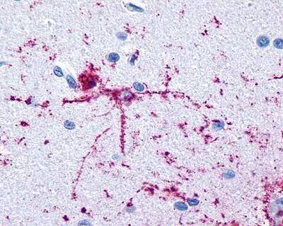 Immunohistochemistry FOXO1A/3/4 Antibody (4E7) - Azide and BSA Free