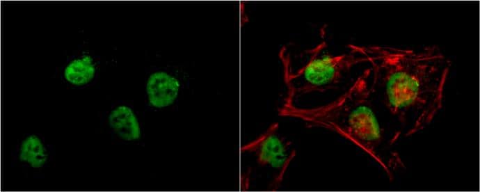 RbAp48 antibody [13D10] detects RbAp48 protein at nucleus by immunofluorescent analysis.Sample: HeLa cells were fixed in 4% paraformaldehyde at RT for 15 min.Green: RbAp48 protein stained by RbAp48 antibody [13D10] (NBP1-41201) diluted at 1:200.Red: phalloidin, a cytoskeleton marker, stained by phalloidin (invitrogen, A12380) diluted at 1:200.Blue: Hoechst 33342 staining. 