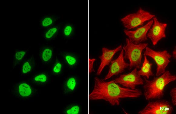 Immunocytochemistry/ Immunofluorescence: RBBP4/RbAp48 Antibody (15G12) [NBP1-41202] - RBBP4/RbAp48 antibody [15G12] detects RBBP4/RbAp48 protein at nucleus by immunofluorescent analysis.Sample: HeLa cells were fixed in 4% paraformaldehyde at RT for 15 min.Green: RBBP4/RbAp48 stained by RBBP4/RbAp48 antibody [15G12] (NBP1-41202) diluted at 1:500.Red: beta Tubulin, a cytoskeleton marker, stained by beta Tubulin antibody  diluted at 1:1000.Scale bar= 10um.