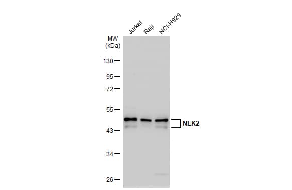 Western Blot: NEK2 Antibody (1B6) [NBP1-41207] - Various whole cell extracts (30 ug) were separated by 10% SDS-PAGE, and the membrane was blotted with NEK2 antibody [1B6] (NBP1-41207) diluted at 1:500. The HRP-conjugated anti-mouse IgG antibody  was used to detect the primary antibody, and the signal was developed with Trident ECL plus-Enhanced.