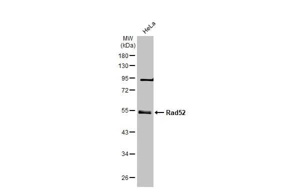 Western Blot: RAD52 Antibody (5H9) [NBP1-41208] - Whole cell extract (30 ug) was separated by 10% SDS-PAGE, and the membrane was blotted with RAD52 antibody [5H9] (NBP1-41208) diluted at 1:500. The HRP-conjugated anti-mouse IgG antibody  was used to detect the primary antibody, and the signal was developed with Trident ECL plus-Enhanced.